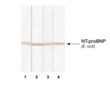 Anti-proBNP antibody [11D1] used in Western Blot (WB). GTX13059